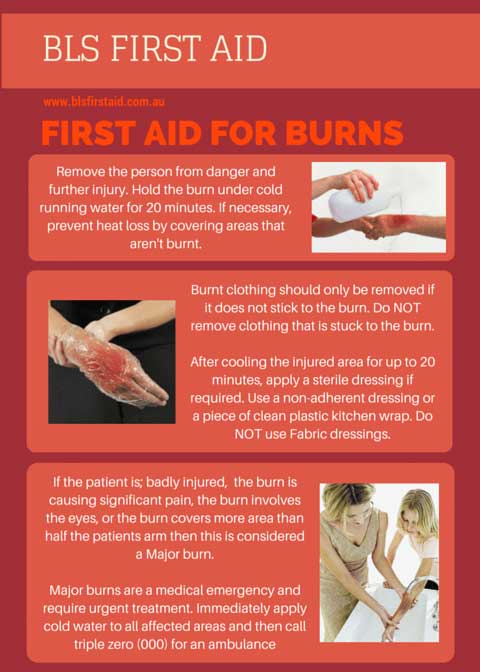 First Aid for burns